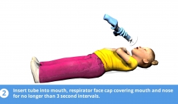 Vụ bé gái tử vong do sặc cháo: Nếu biết cách cấp cứu kịp thời có thể cứu mạng trẻ